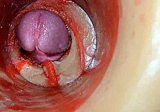 Huge Ejaculation Floods Deep Inside - Internal Camera Catches Every Creampie Drop!