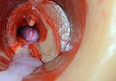 Huge Ejaculation Floods Deep Inside - Internal Camera Catches Every Creampie Drop!