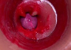 POV Camera Films Cervix Creampie from Monster Cock Vaginal Pounding
