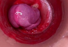 POV Camera Films Cervix Creampie from Monster Cock Vaginal Pounding