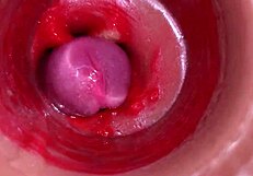 POV Camera Films Cervix Creampie from Monster Cock Vaginal Pounding