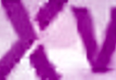 Ass Fisting Highlights: Jureka Del Mar Kyra Sex Huge Gapes