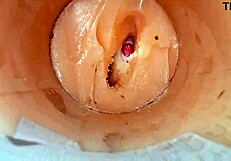 Camera shoved deep inside tight shaved pussy catches monster cum explosion creampie close up