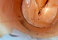 Camera shoved deep inside tight shaved pussy catches monster cum explosion creampie close up